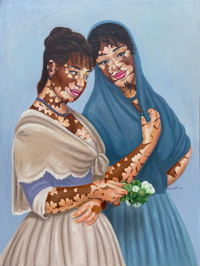 'Beautiful Vitiligo Ladies' figurative oil painting by artist Ganiyat Abdulazeez, 48x36 inch, on canvas