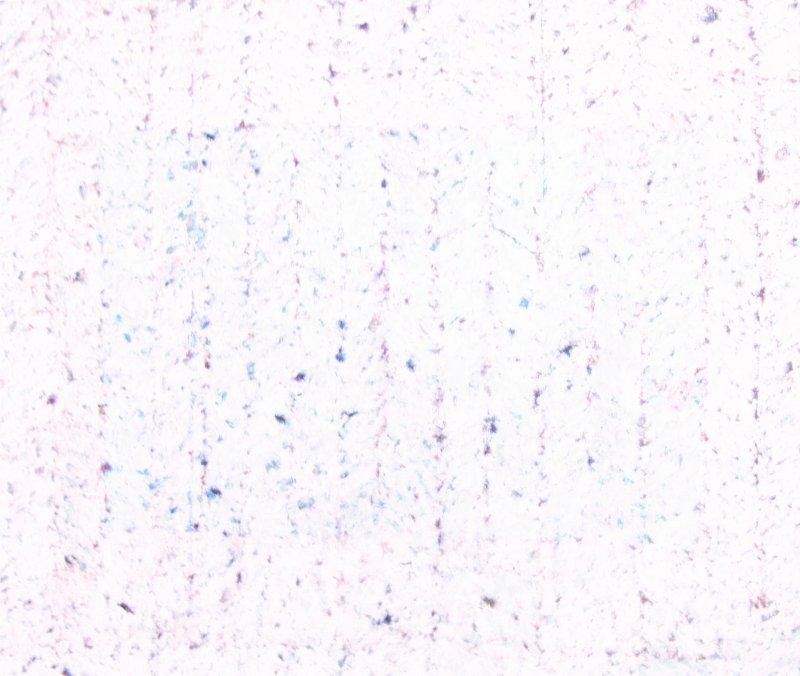 Abstract mixed media painting titled 'Untitled 20', 20x23 inches, by artist Anil Tagad on Canvas